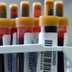 Blood samples about to be tested for covid-19 antibodies at a clinic in Moscow on May 15, 2020